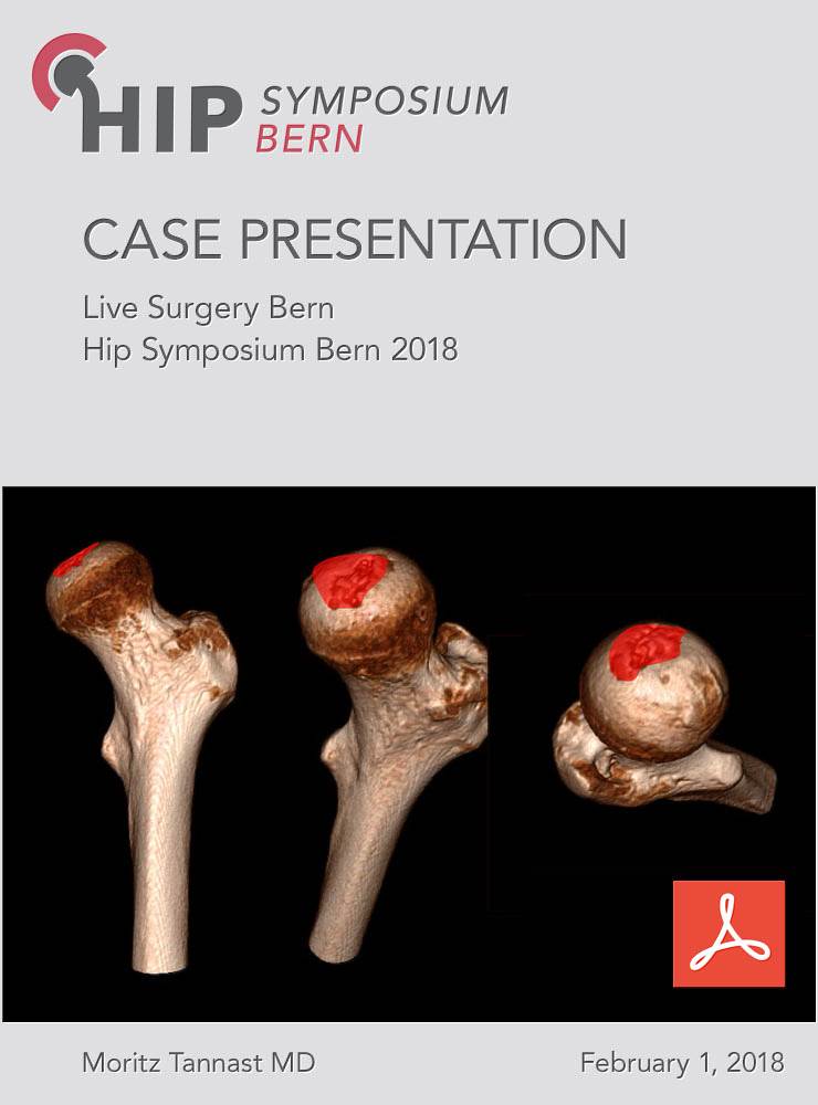 Case Presentation Live Surgery Bern