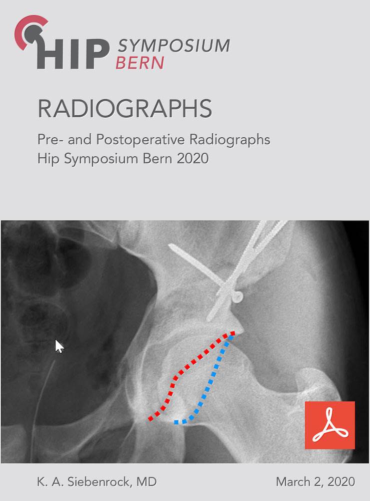 Live Surgery – Pre- and Postoperative Radiographs
