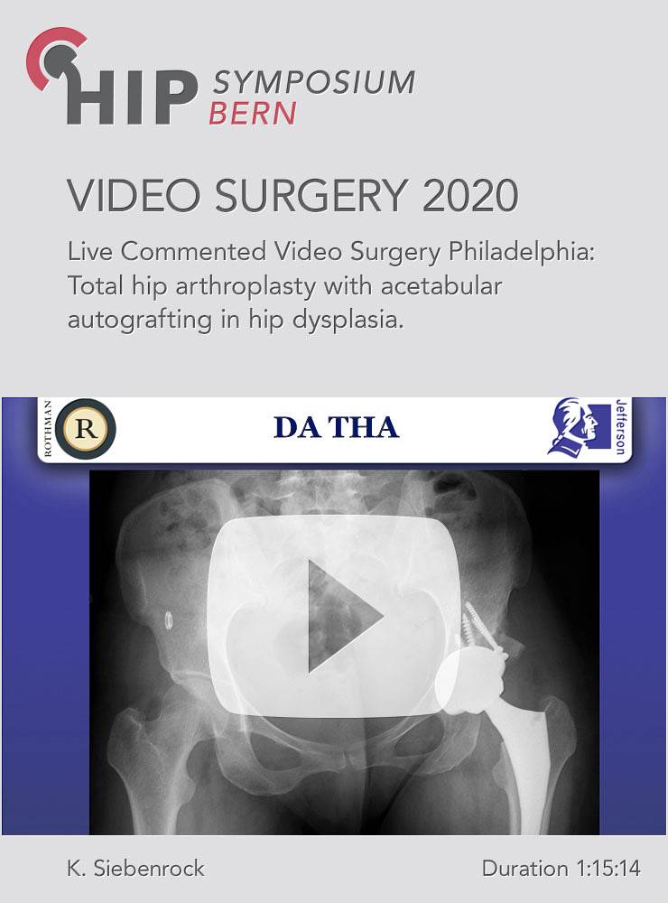 Live commented video Surgery from Rothman Institute, Philadelphia / J. Parvizi