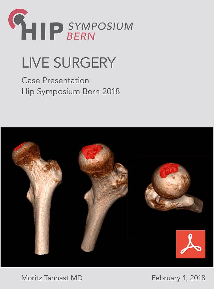 Case Presentation Live Surgery Bern