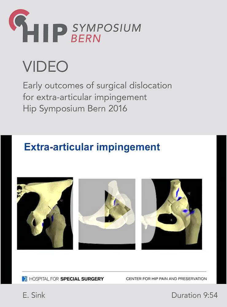 E. Sink - Early outcomes of surgical dislocation for extra-articular impingement - Hip Symposium 201