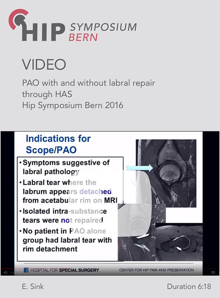 E. Sink - PAO with and without labral repair through HAS - Hip Symposium 2016