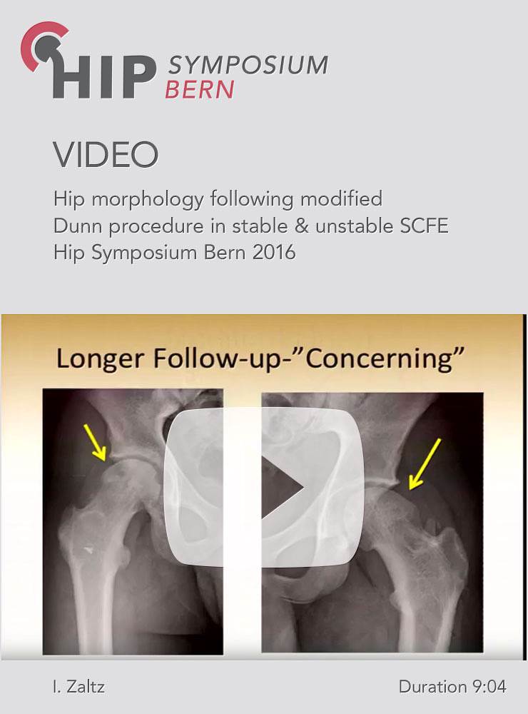 I. Zaltz - Hip morphology following modified Dunn procedure in stable & unstable SCFE - Hip Symposiu