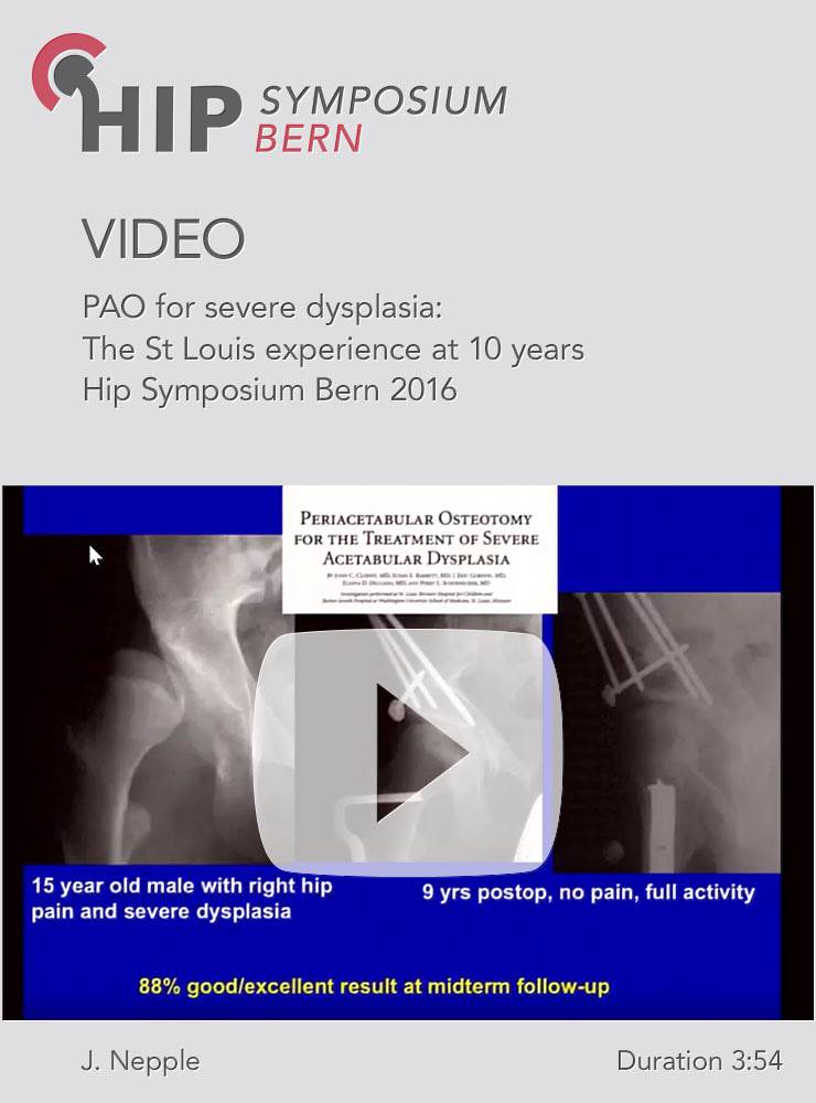 J. Nepple - PAO for severe dysplasia: The St Louis experience at 10 years -  Hip Symposium 2016