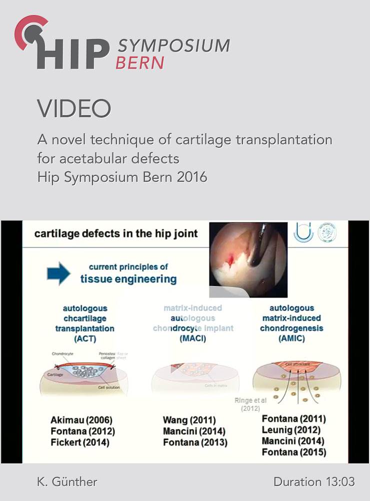 K. Günther - A novel technique of cartilage transplantation for acetabular defects - Hip Symposium 2