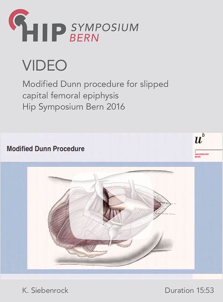 K. Siebenrock - Modified Dunn procedure for slipped capital femoral epiphysis - Hip Symposium 2016