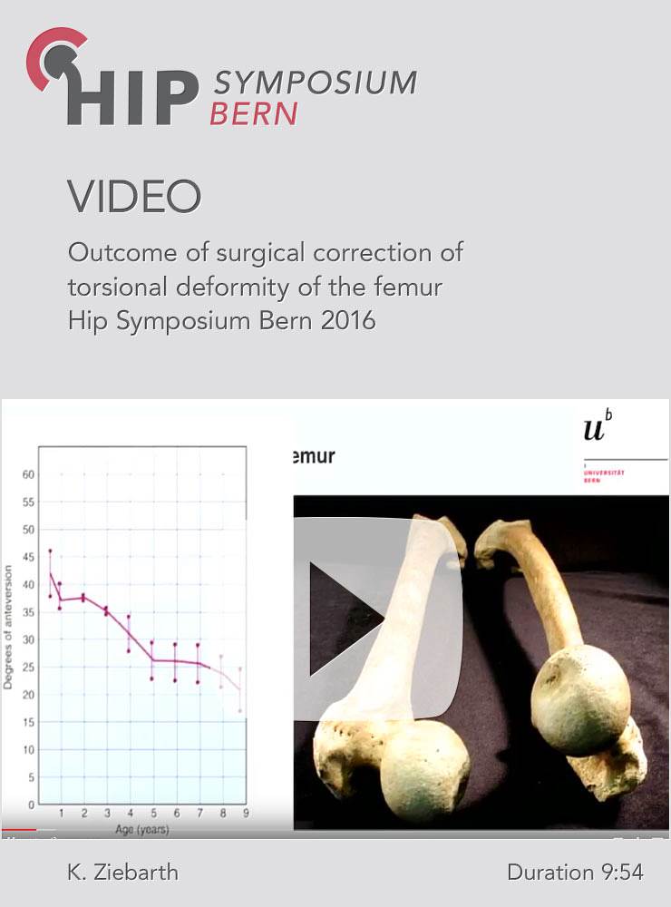 K. Ziebarth - Outcome of surgical correction of torsional deformity of the femur - Hip Symposium 201