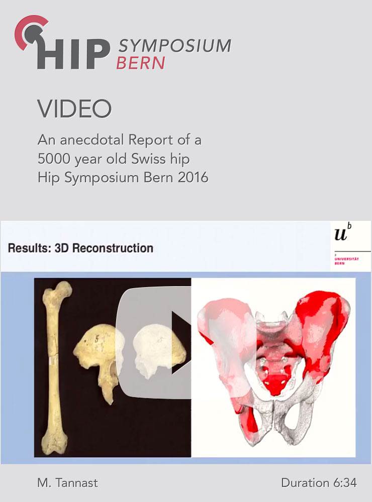 M. Tannast - An anecdotal Report of a 5000 year old Swiss hip - Hip Symposium 2016