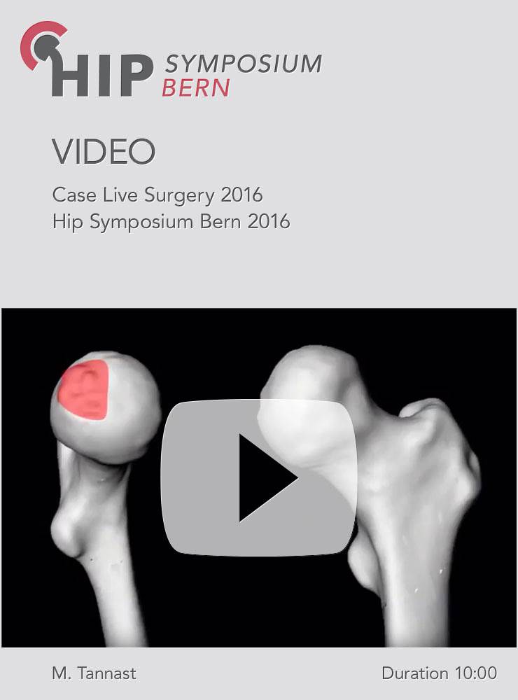M. Tannast - Case Live Surgery 2016 - Hip Symposium 2016