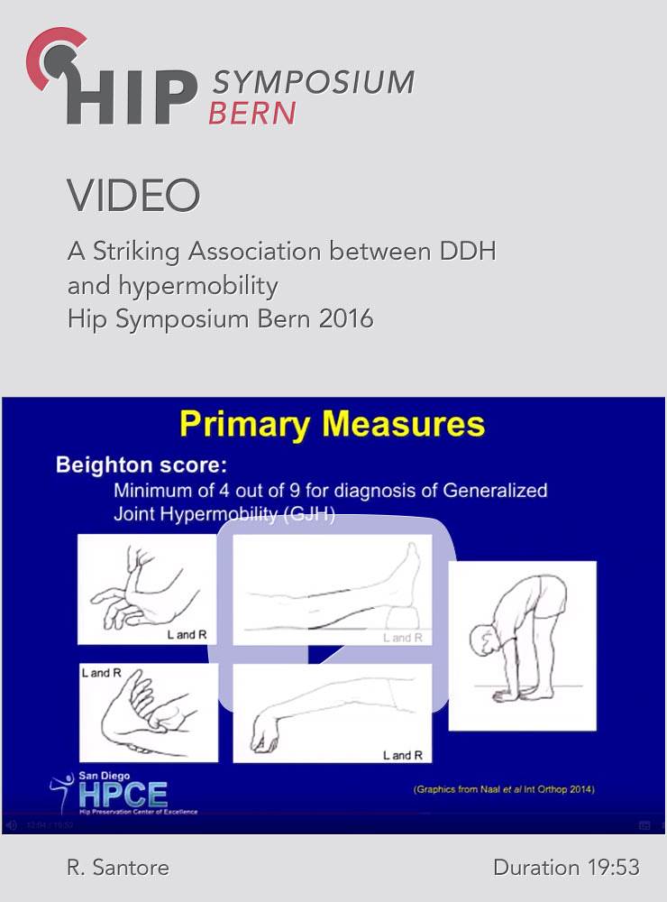 R. Santore - A Striking Association between DDH and hypermobility - Hip Symposium 2016