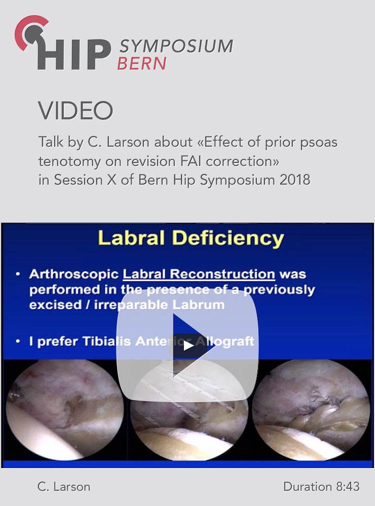 C. Larson - Effect of prior psoas tenotomy on revision FAI correction - Hip Symposium 2018