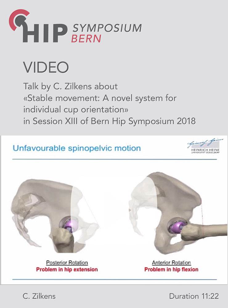 C. Zilkens - Stable movement: A novel system for individual cup orientation -Bern Hip Symposium 2018