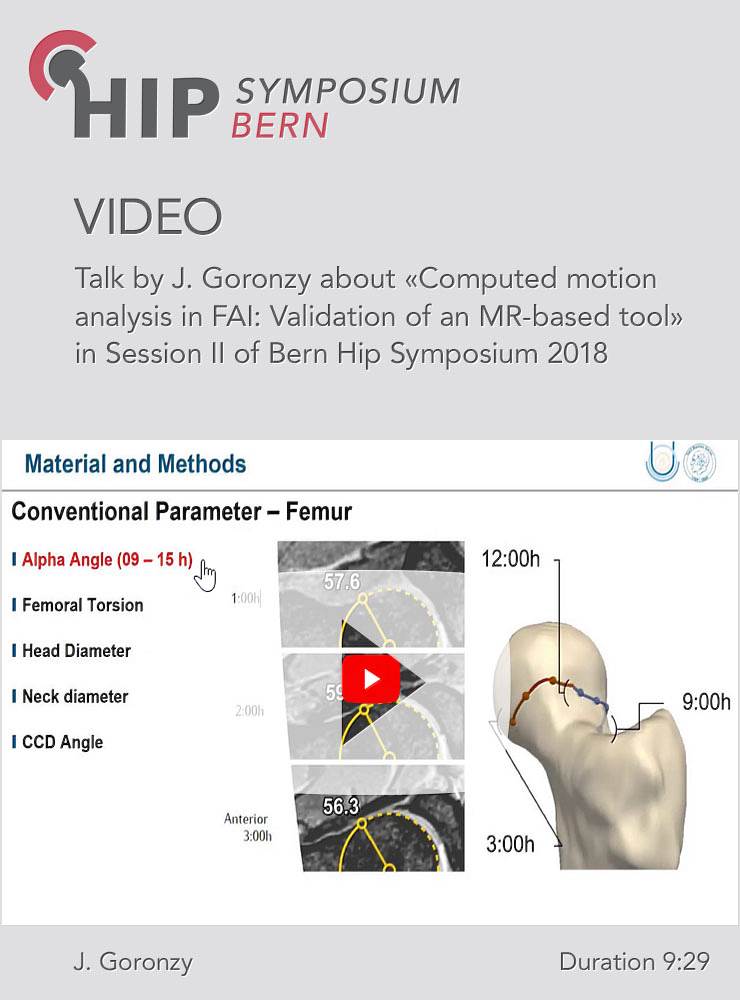 J. Goronzy - Computed motion analysis in FAI: Validation of an MR-based tool - Hip Symposium 2018