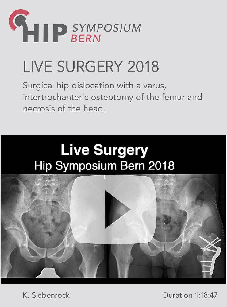 Live Surgery / Hip Symposium 2018