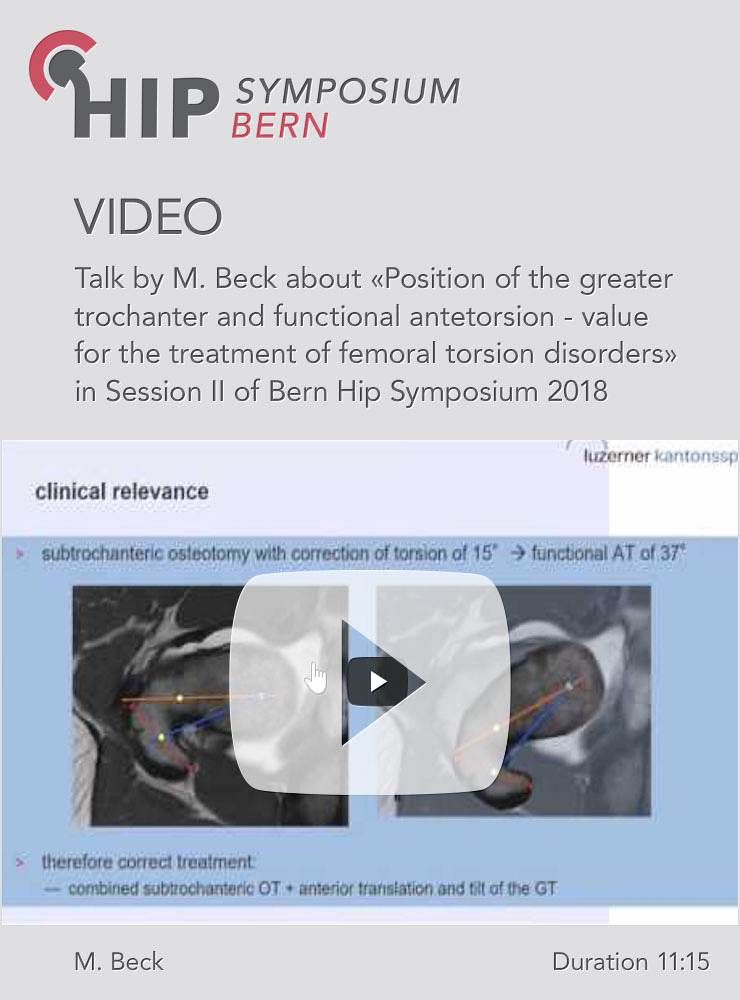 M. Beck - Position of the greater trochanter and functional antetorsion -  Hip Symposium 2018