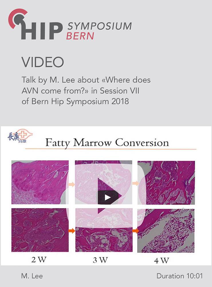 M. Lee - Where does AVN come from? - Hip Symposium 2018