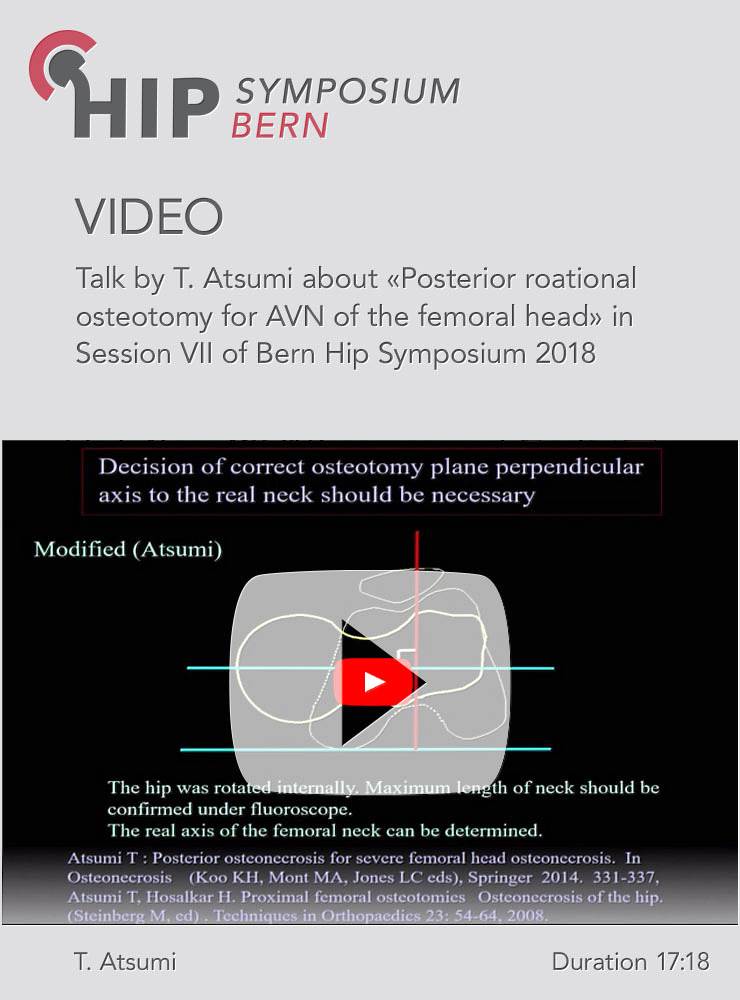 T. Atsumi - Posterior roational osteotomy for AVN of the femoral head - Hip Symposium 2018