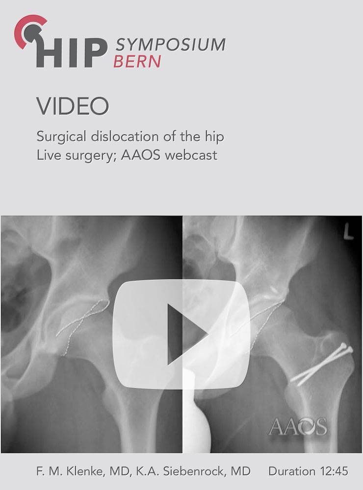 Surgical dislocation of the hip