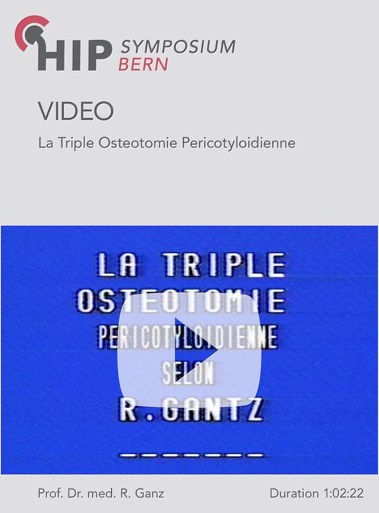 La Triple Osteotomie Pericotyloidienne