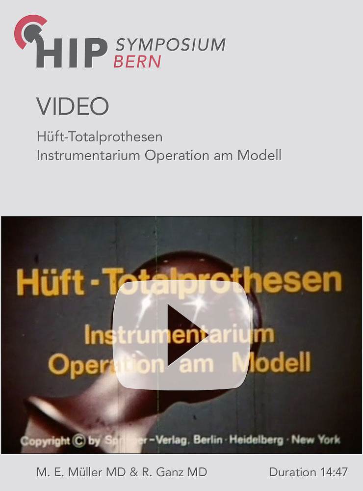 Hüfttotalprothesen Instrumentarium Operation am Modell M E Müller und R Ganz Springer Verlag