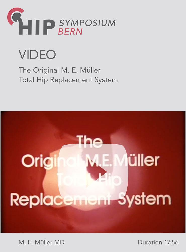 The original M E Müller Total Hip Replacement System Springer Verlag