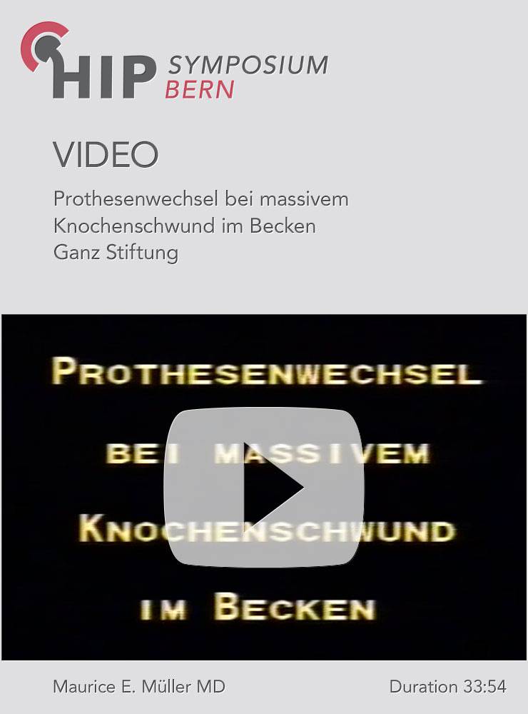Prothesenwechsel bei massivem Knochenschwund im Becken Ganz Stiftung Maurice E Müller Bern