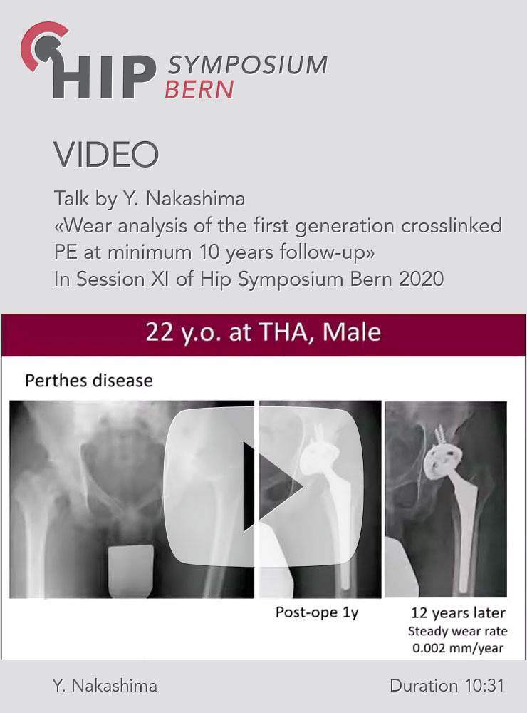 Wear analysis of the first generation crosslinked PE at minimum 10 years follow-up / Y. Nakashima