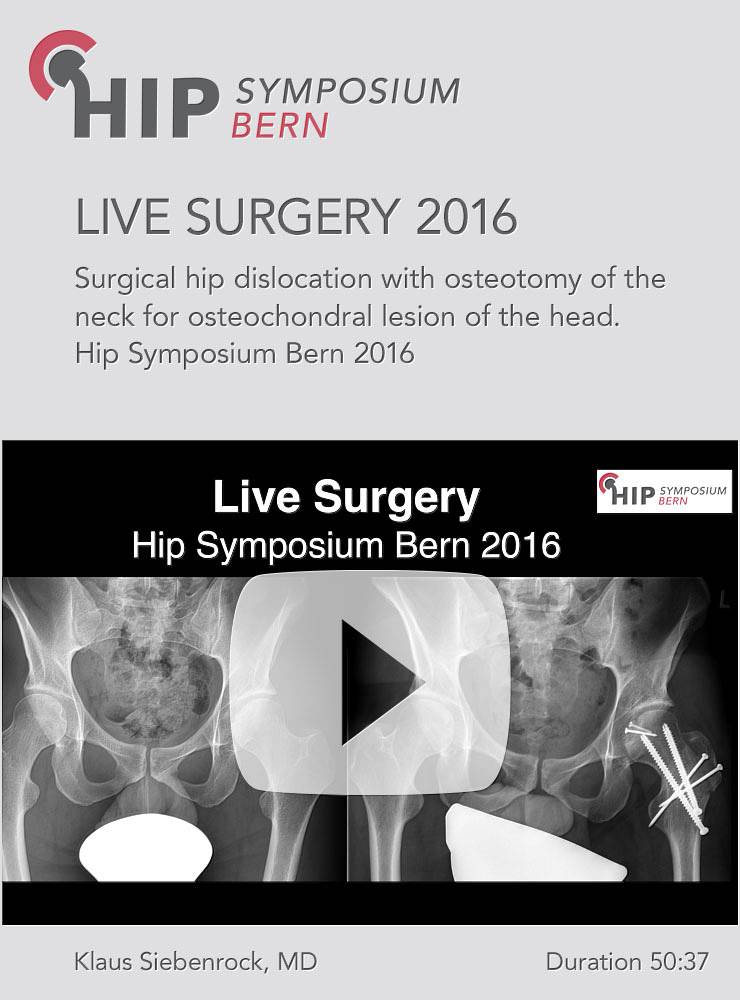 Live Surgery Bern 2016