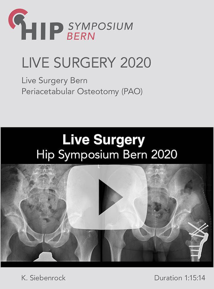 Live Surgery Hip Symposium 2020 / K. Siebenrock