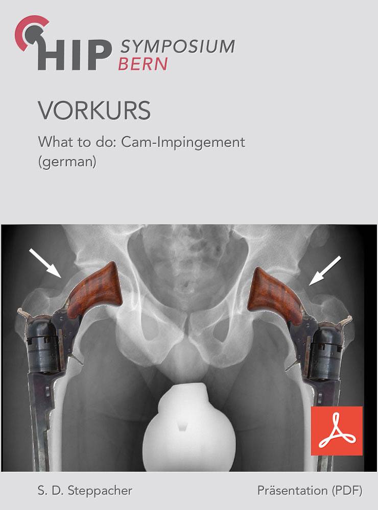 What to do: Cam-Impingement