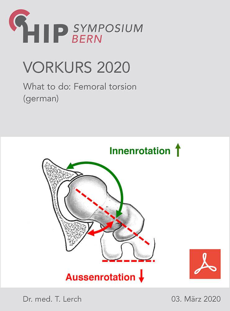 What to do: Femoral torsion